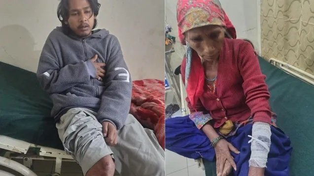 भालू ने हमला कर एक ही परिवार के चार लोगों को किया घायल